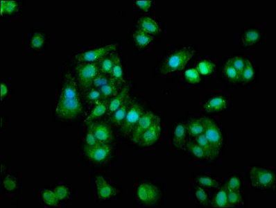 S100A1 Antibody