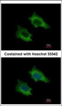 PRPSAP2 antibody [N1C3]