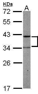 PRPSAP2 antibody [N1C3]