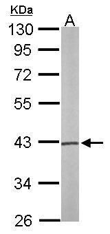 phosphoserine aminotransferase 1 Antibody