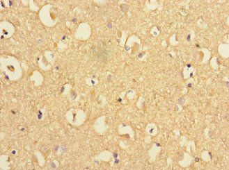 PSEN1 Antibody