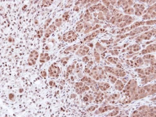 proteasome subunit alpha 7 Antibody