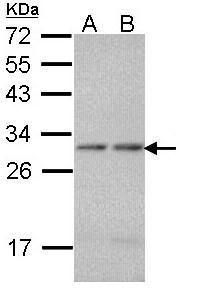 proteasome subunit alpha 7 Antibody