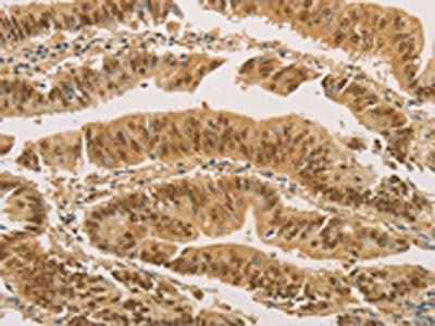 PSMB7 Antibody