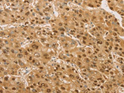 PSMB7 Antibody