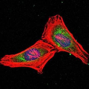 PSMB8 Antibody