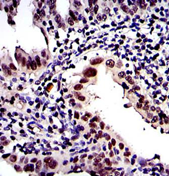 PSMB8 Antibody