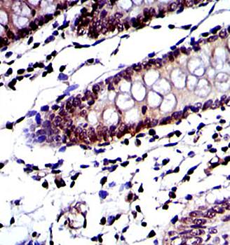 PSMB8 Antibody