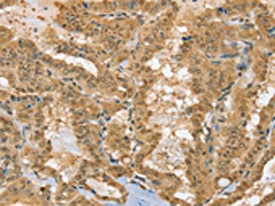 PSMC1 Antibody