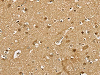 PSMC1 Antibody