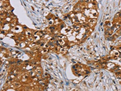 PSMC2 Antibody