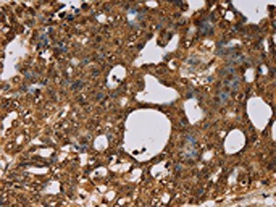 PSMC2 Antibody