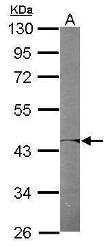 PSMC6 Rabbit Polyclonal Antibody