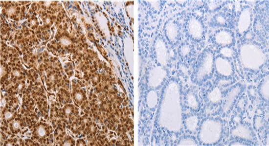 PSMD3 Rabbit Polyclonal Antibody
