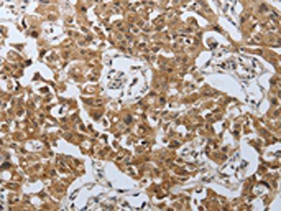 PSMD6 Antibody