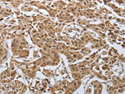 PSMD6 Antibody
