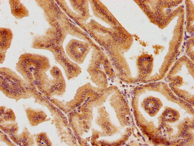 PSMD6 Antibody