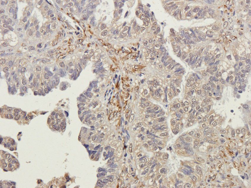 PTCH1 Rabbit Polyclonal Antibody