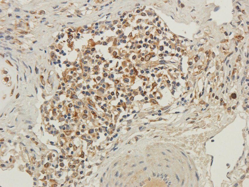 PTCH1 Rabbit Polyclonal Antibody