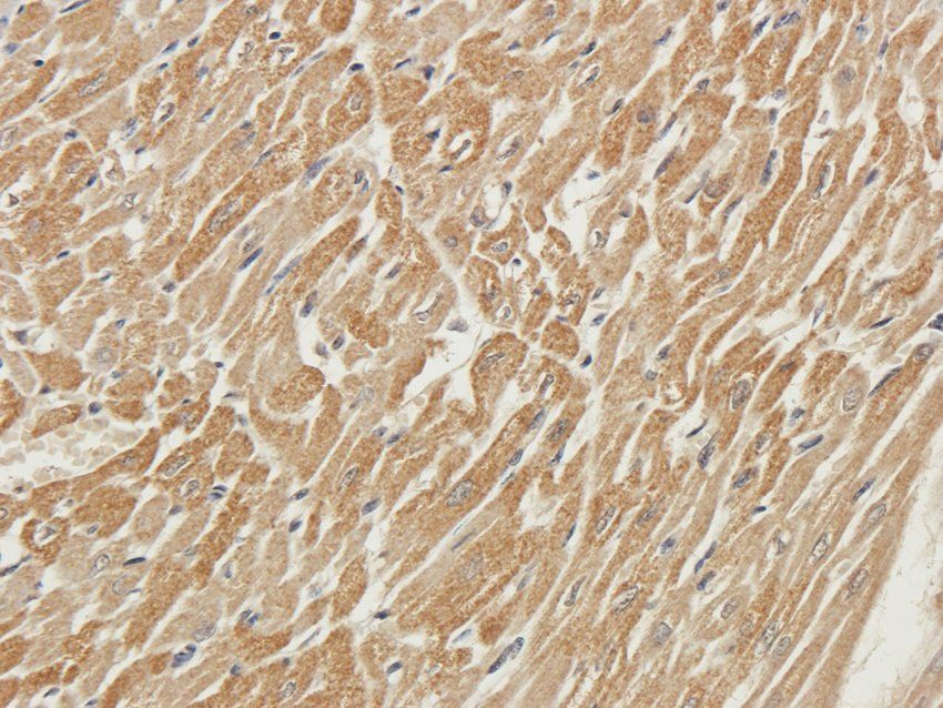 PTCH1 Rabbit Polyclonal Antibody