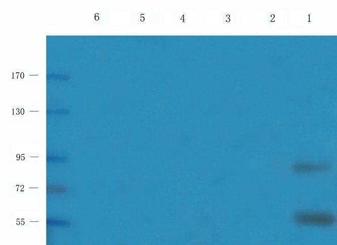 PTCH1 Rabbit Polyclonal Antibody