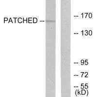 PTCH1 Antibody