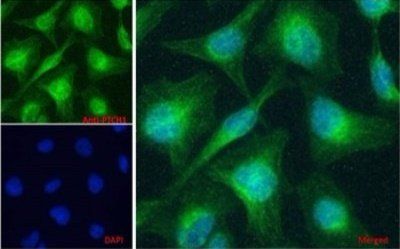 PTCH1 (aa266-280) Antibody