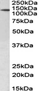 PTCH1 (aa266-280) Antibody