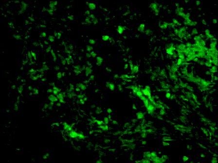 Patched Rabbit Polyclonal Antibody (FITC)