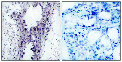 PTEN Antibody