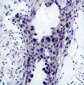 PTEN (Ab-380/382/383) Antibody
