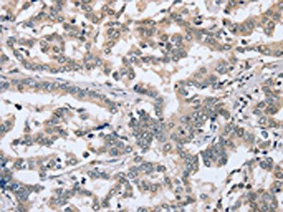 PTGER1 Antibody