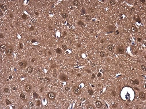 PTGFRN antibody [C3], C-term