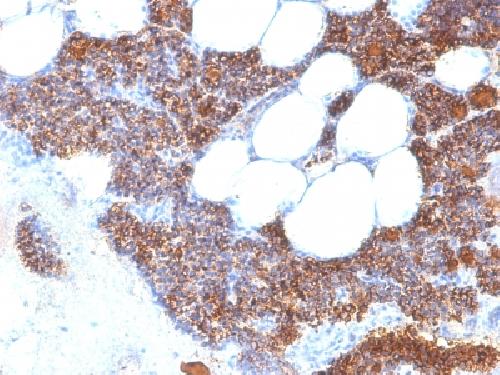 PTH Antibody