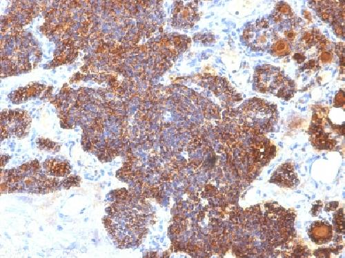 PTH Antibody