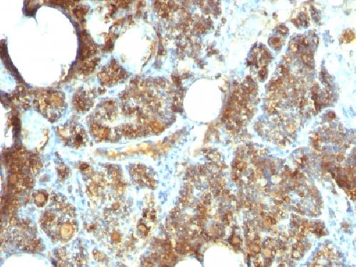 PTH Antibody