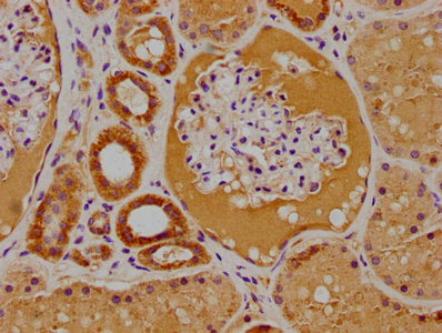 PTK7 Antibody