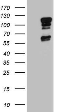 TWF1 Antibody