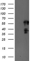 PTPN1 Antibody
