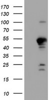PTPN1 Antibody