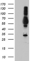 PTPN1 Antibody