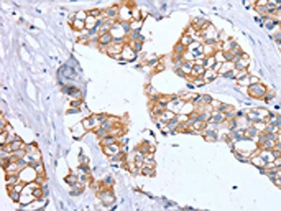 PTP4A2 Antibody