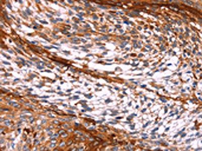 PTPN13 Antibody