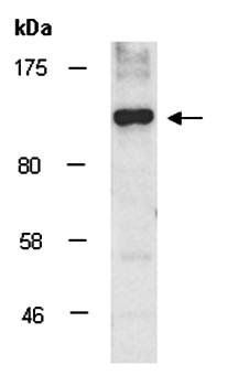 PTPN14 (N) Antibody, Rabbit Polyclonal