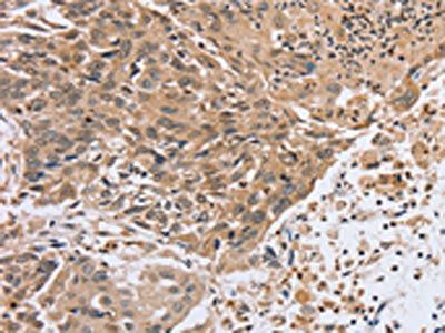 PTPN4 Antibody