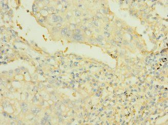 PTPRJ Antibody