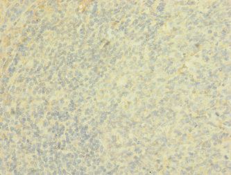 PTPRJ Antibody