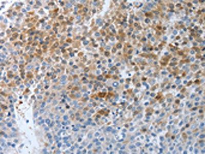PTPRJ Antibody