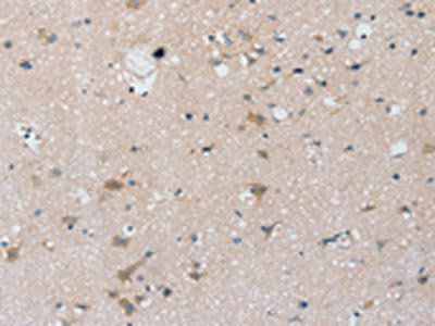PTX3 Antibody