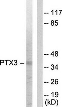 PTX3 Antibody